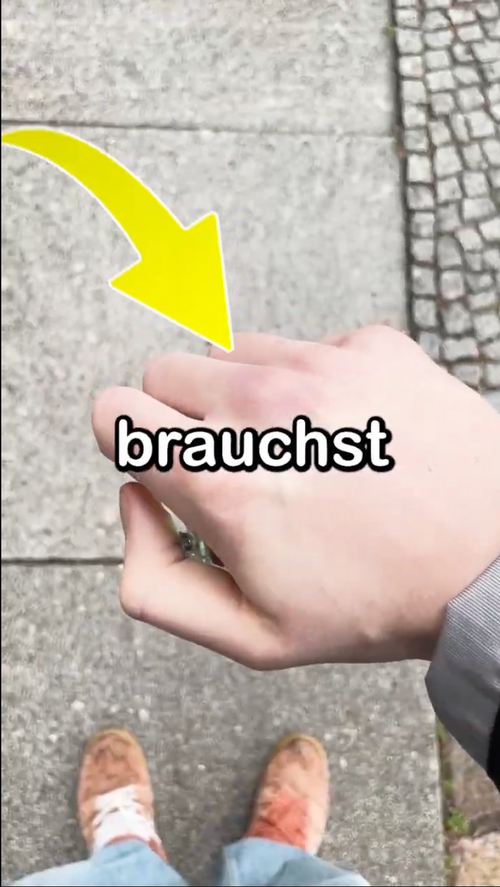 Logitechs größter Fehler.